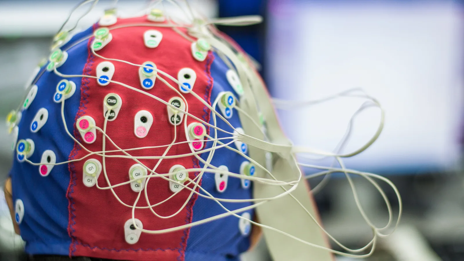QEEG sensor placement during a neurofeedback session